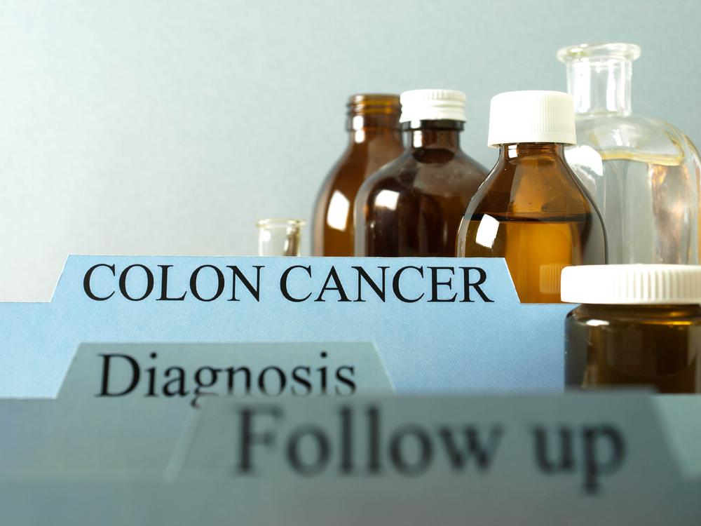 Know about staging colon cancer