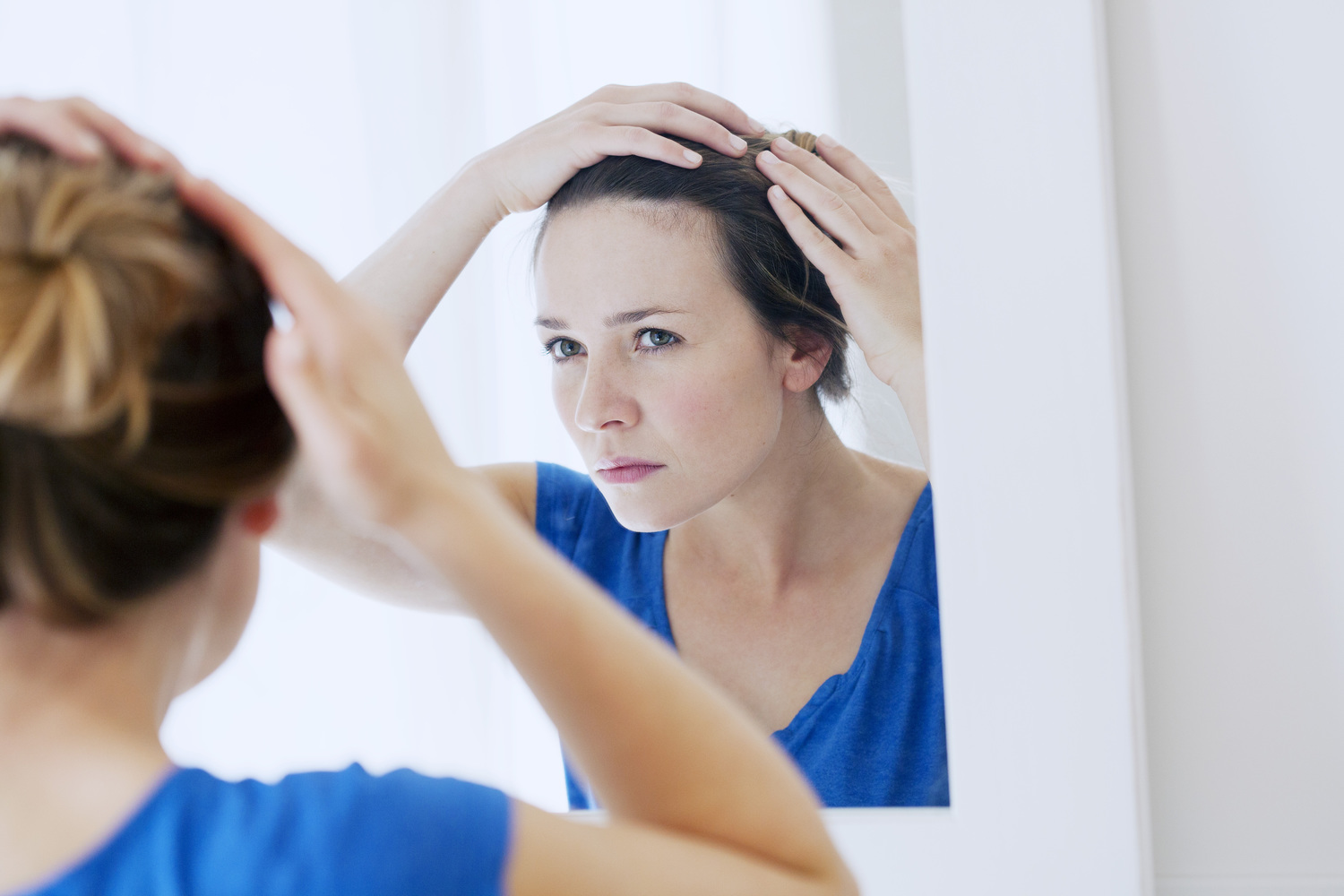 Natural Treatments to Combat Hair Loss